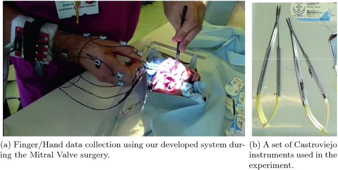 Figure from Towards Finger Motion Tracking and Analyses for Cardiac Surgery